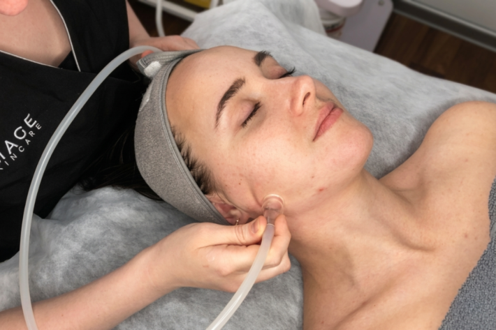 Vakuuma masāža sejai